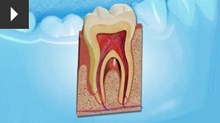 healthy gum service in chrysalis dental practice in bedford practice