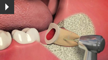 Orral surgery practice in chrysalis dental practice in bedford practice