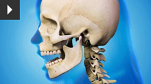 jaw problems at chrysalis dental practice in bedford practice